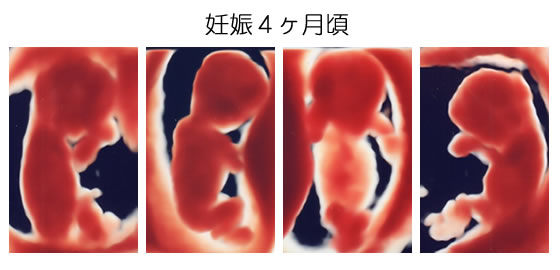 3d 4d超音波写真 産婦人科 内科 小児科 不妊治療